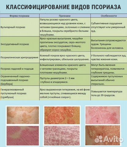 Доброволец в медицинских испытаниях по псориазу