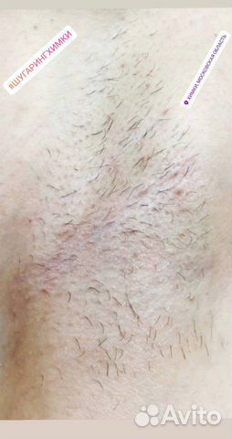 Шугаринг, Воск (Куркино, Химки) Шугаринг, Воск (Куркино, Химки)