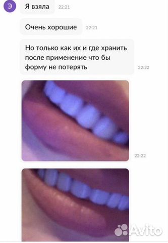 Виниры Snap on Smile Виниры Snap on Smile