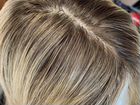 Система замещения волос (натуральные волосы)